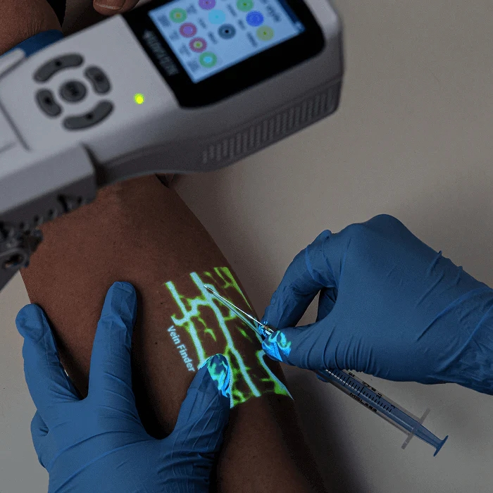 Vein Finder System